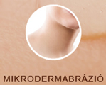 MIKRODERMABR&Aacute;ZI&Oacute;